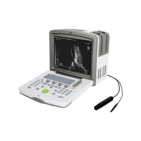 WELLD威尔德眼科A/B超声波诊断系统WED-5100