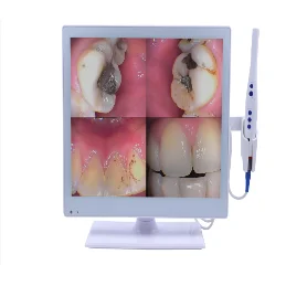 佰嘉莉口腔内窥镜+17寸医用显示屏(带WiFi)CF-687