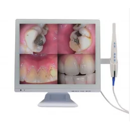 佰嘉莉口腔内窥镜+17寸医用显示屏一体机CF-989