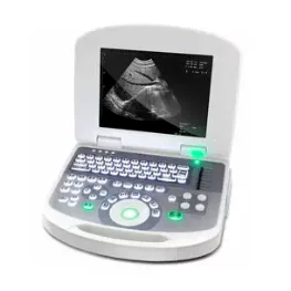 Sunway Medical便携式B超机 3W-2100