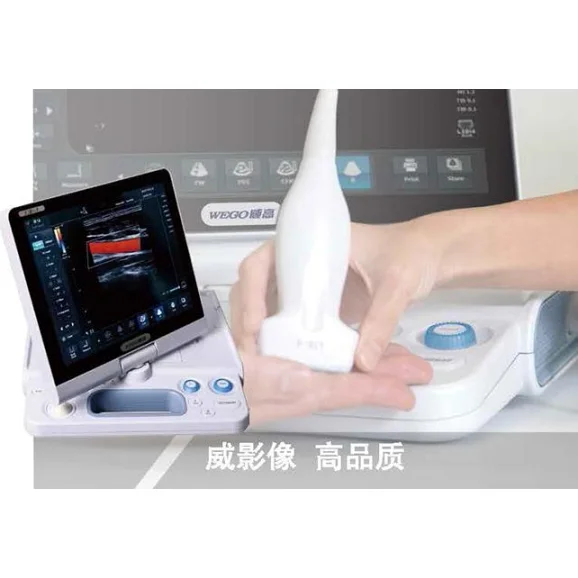 威高便携式彩色超声诊断仪UE-1