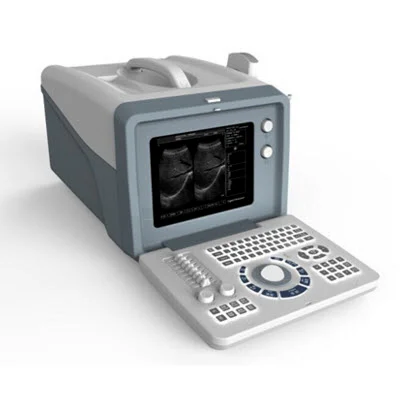 超声显像诊断仪SS-5Plus