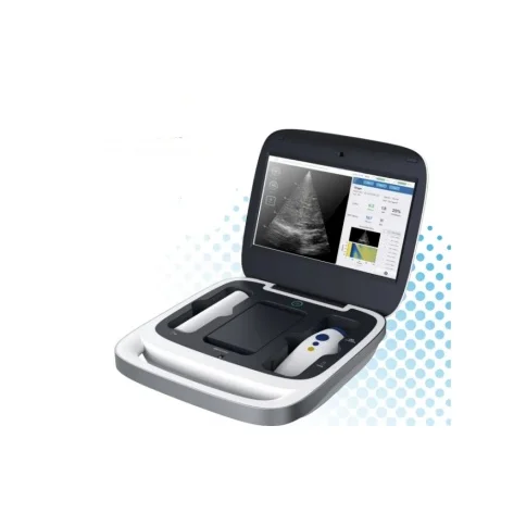 意领定量剪切波超声肝脏测量仪Liverscan Mobile