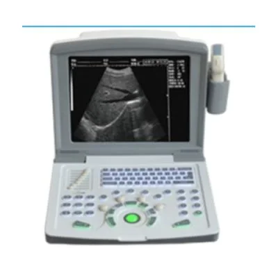 迈瑞Mindray全数字超声诊断系统RH-300A