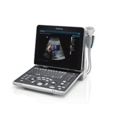 迈瑞 Mindray 便携式彩色多普勒超声系统 Z50BW