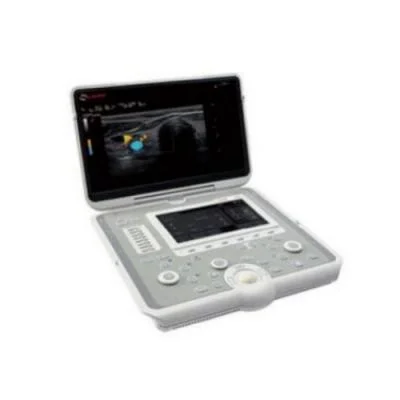 百胜 esaote超声诊断系统Sigma