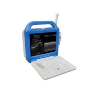 凯尔液晶便携式B超机KR-1288Z