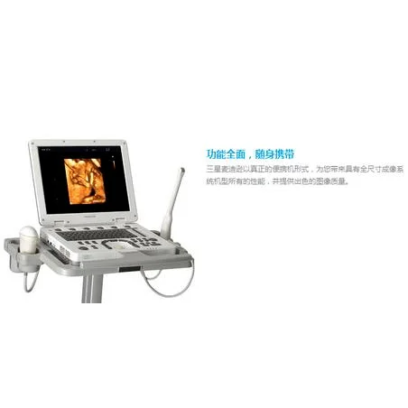 三星麦迪逊便携式超声诊断仪MySono U5